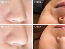 コウベ美容鍼灸治療院(KOBE美容鍼灸治療院)