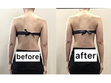 エスデザイン(es design)/首こり/肩コリ/パワーレメディ