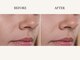 ティアラ(TIARA)の写真/《韓国芸能人ピーリング》毛穴レス陶器肌♪驚く保湿力！紫外線対策×乾燥予防◎【ムルトックス¥8800】