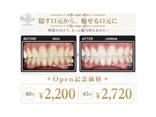 ロエル 出雲(RoELe)