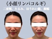 ジェイオー(J.O)