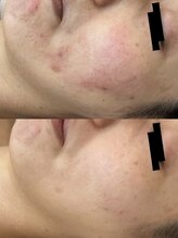 リラクゼーションエステ モア(MORE)/敏感なお肌にも