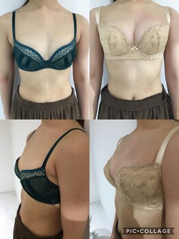 エスグレース 心斎橋(S.grace)/シンデレラバストアップ施術