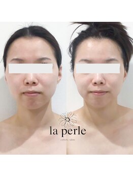 ラペール 岡山店(la perle)/