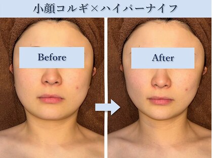椿(TSUBAKI)の写真