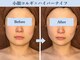 椿(TSUBAKI)の写真