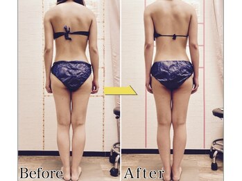 整体 美容サロン フェールラヴィ/【美容・骨格整体】