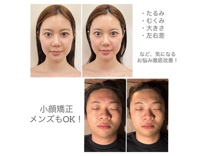 アンスリウムの写真