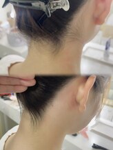 アイズ ビューティケア(eyes. beauty care)/気になるうなじの産毛に WAX脱毛