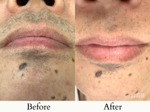 towasmile/ビフォーアフター