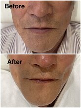 クラッシー 本八幡(CLASSY+)/肌のこな吹きとかゆみが改善！