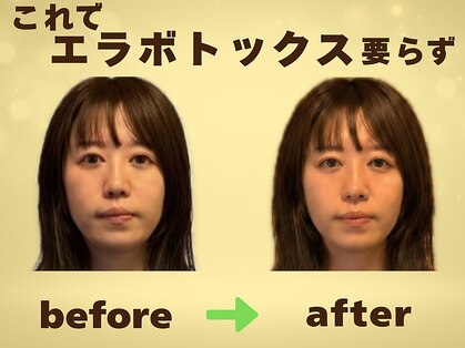 カラダリセット 上本町の写真