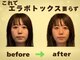 カラダリセット 上本町の写真