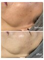 レディー(Lady)/Lady totalbeautysalon