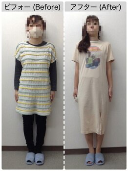 【耳つぼ専門/痩身/骨盤矯正】ヘルシースリムライフ新所沢店の写真/【新所沢★ぽっこりお腹撃退】骨盤の歪みチェック×耳つぼ刺激！産後太り・更年期もスッキリくびれへ♪