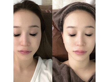 ダイヤモンドビューティー(Diamond Beauty)/学割最新リフトアップマシーン