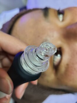 エステルーム クリスタル/【ビックリ写真】皮脂汚れ