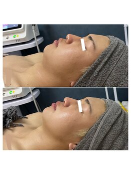 ビビ(Be_bi)/時代はメンズ美容！