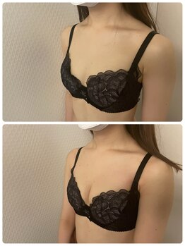 プレフィール(PLEAFEEL)/