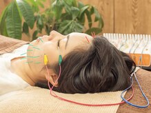 鍼灸ライフ整骨院/■電気を流す美容鍼