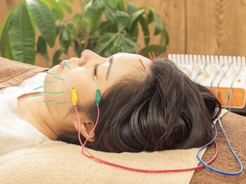 鍼灸ライフ整骨院/■電気を流す美容鍼