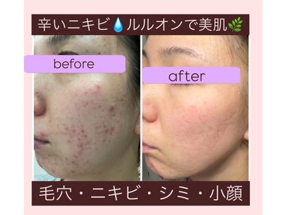 ヨサパーク リアン(YOSA PARK Lien)の写真