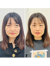 赤沼鍼灸整骨院/美・健康・笑顔に導く美容鍼