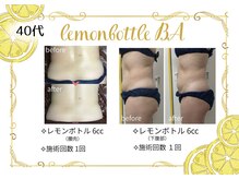 アヤエステティックサロン 綱島店(AYA)/地域密着で20年