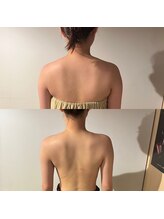 カシェット(cachette)/ブライダルエステ