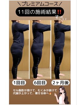 ヨサパーク ココル(YOSA PARK CoCoLu)/体型の変化