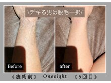 ワンエイト(One Eight)