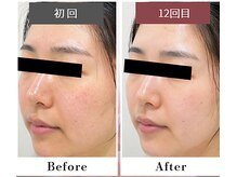 フルリール/【UVプロテクション】