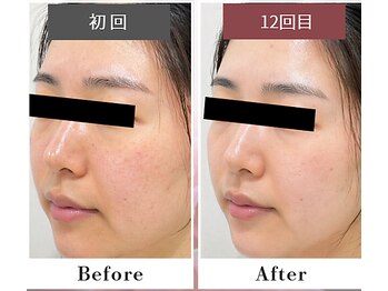 フルリール/【UVプロテクション】