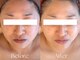 ハートフレンド(Heartfriend)の写真