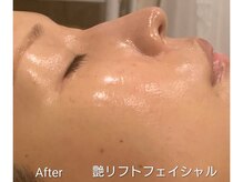 アンジュ(Anju)の雰囲気（韓国肌管理ダクトピール×凛リフト。凛とした美しい顔立ちを作る）