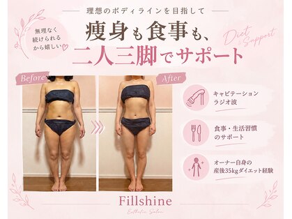 トータル フィルシャイン(Total Fillshine)の写真