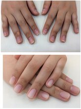 シャンネイルケアサロン(Shan Nail caresalon)/傷んだお爪もお任せ下さい！