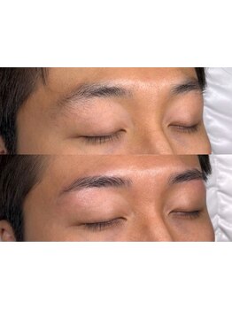 メンズフェイシャル