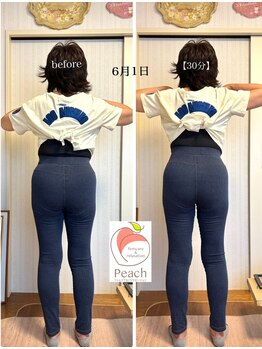 ピーチ鍼灸整体治療院(Peach鍼灸整体治療院)/