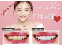 エクシアホワイト 山形西バイパス店
