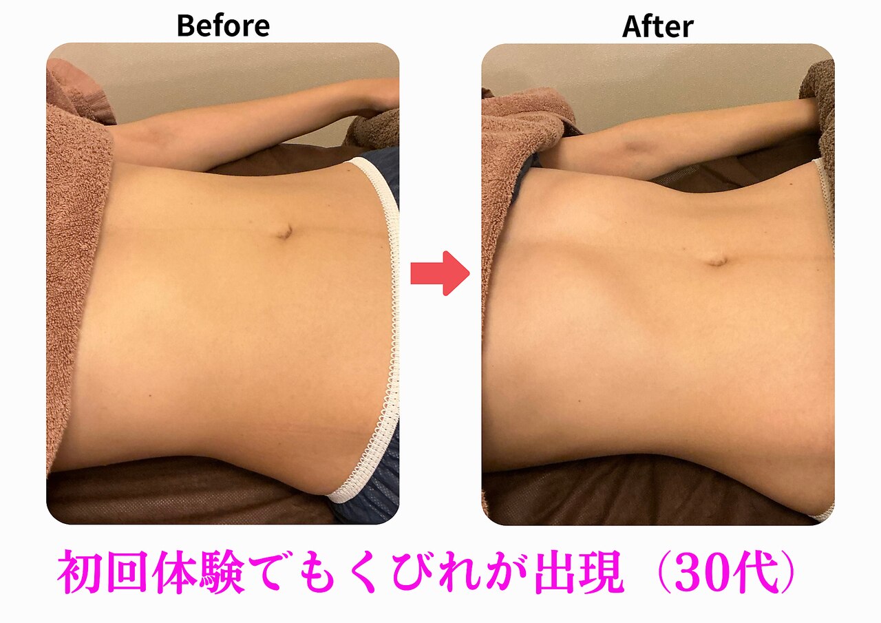 本格家庭用痩身エステ 痩身エステ人気ランキング2026！体験1回でもしっかり痩せると人気な