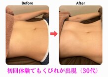 エーシーサロン 六本木店(acsalon)