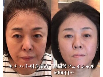 【LEDまつエク専門店】Beauty salon Turuccare /お顔の印象アップ