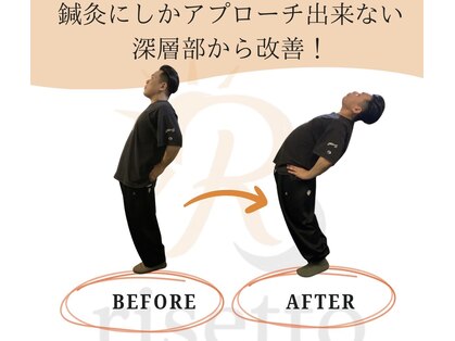 リセット鍼灸院(Risetto鍼灸院)の写真