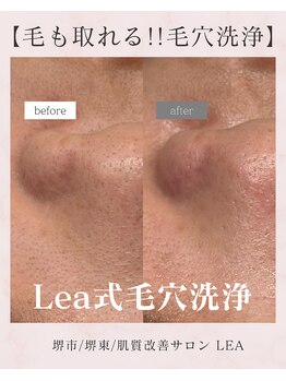 レア(Lea)/メイクのりも良くなります＊