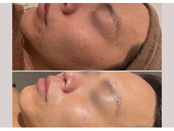 ケアバイルドホリエ(CARE by le dos HORIE)/CHRISTINA ビオフィート