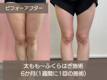 ★初回体験で効果を実感されたお客様は脅威の100パーセント！