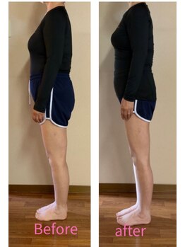 アルマ(ALMA)/60代女性：6ヶ月-5.4kg!