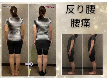 プルーム 大橋店(plume)/反り腰/腰痛/ぽっこりお腹