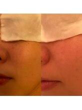 凪 横浜/ダークスポットにも